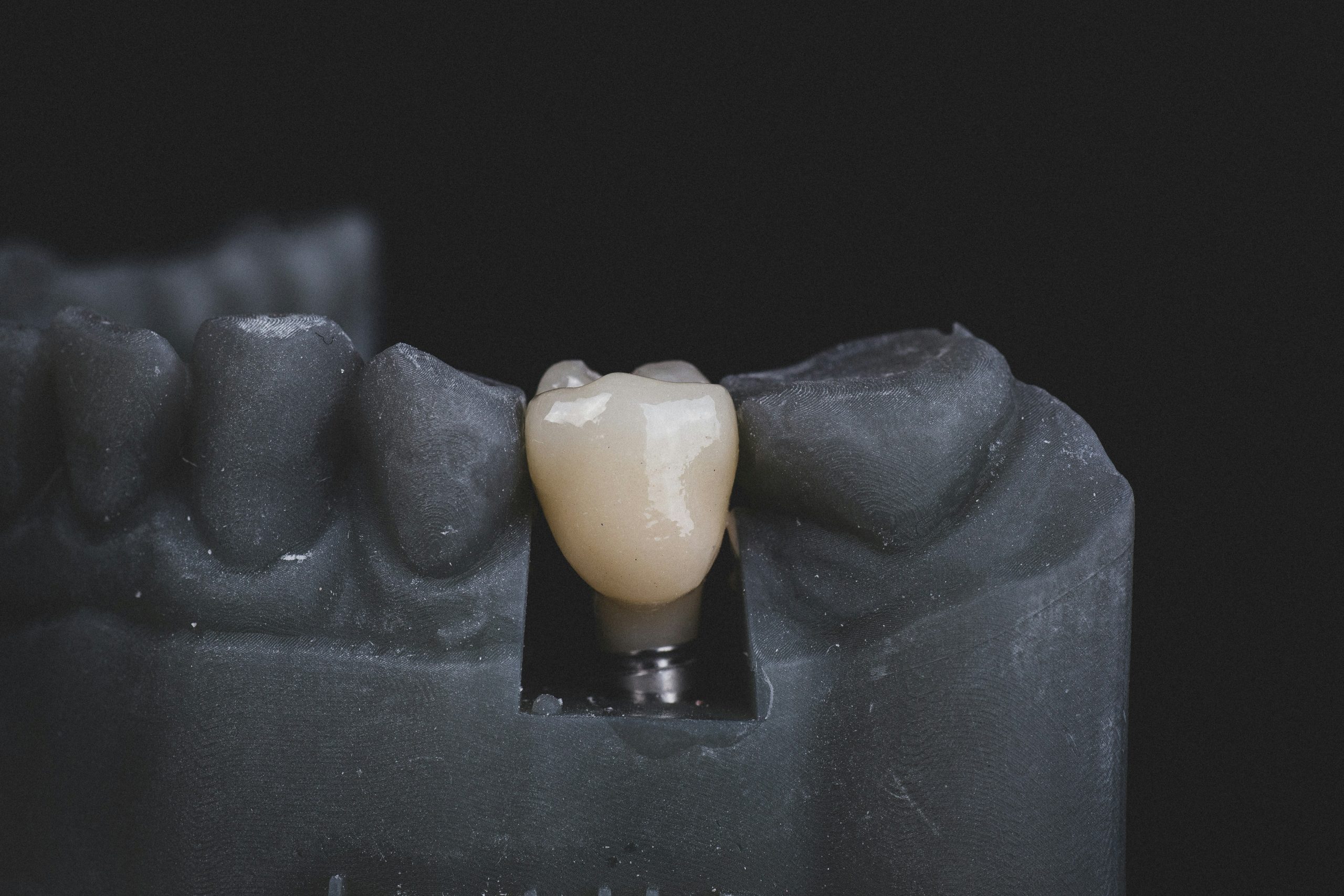 bogdan condr q1klbswf70y unsplash (1)